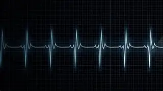 How to calculate heart rate from ECG